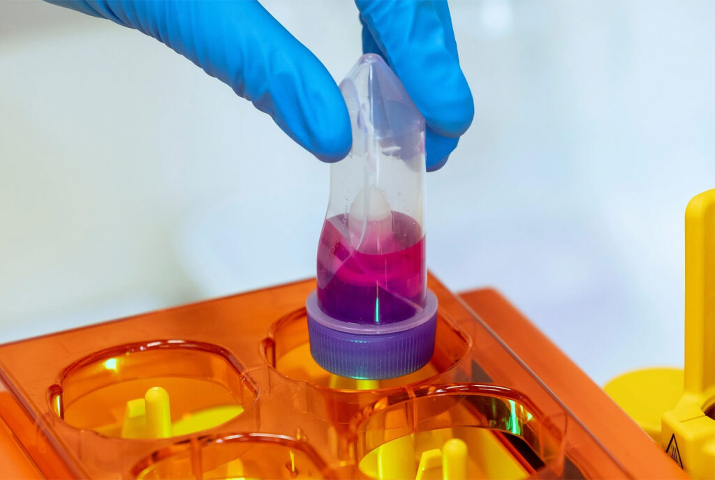 Medizinische Innovation als möglicher Paradigmenwechsel in der Chemotherapie
